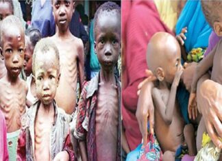 Nigeria burdened by 2m acute malnourished children – UNICEF