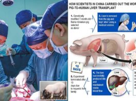 Chinese scientists perform first pig-to-human liver transplant